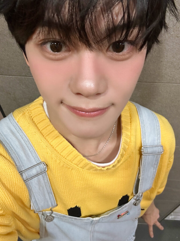 キムギュビン　整形　顔変わった